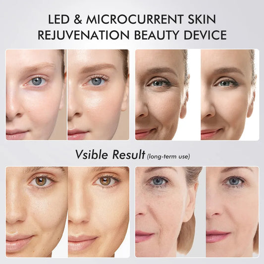AGE R-BOOSTER PRO BeamBelle